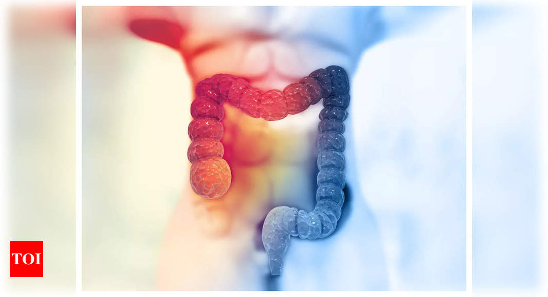 Colon cancer symptoms: As colorectal cancer cases increase in India, do not miss these early signs – Times of India