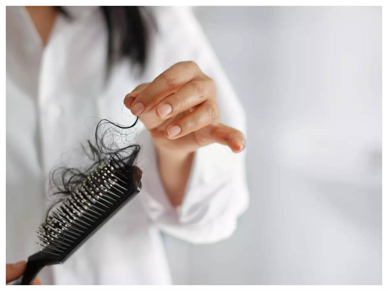 When Hair Loss Is Not Genetic  Everyday Health