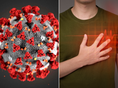 Recent heart attacks may be linked to COVID