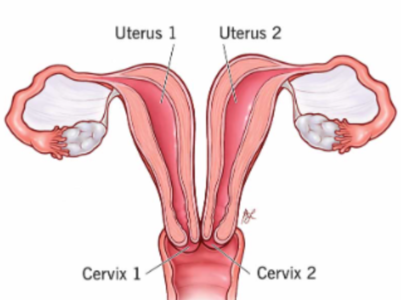 Mom-of-two has 2 vaginas and double uterus