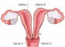 Mom-of-two has 2 vaginas and double uterus