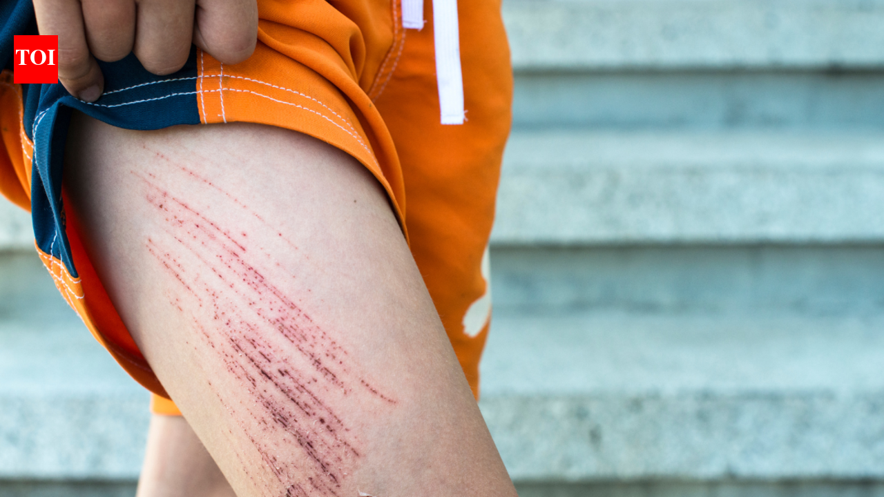 5 ways to prevent and heal from gym injuries