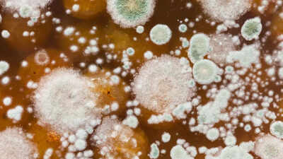 In a probable world first, plant fungus infects ‘mushroom’ man from Kolkata