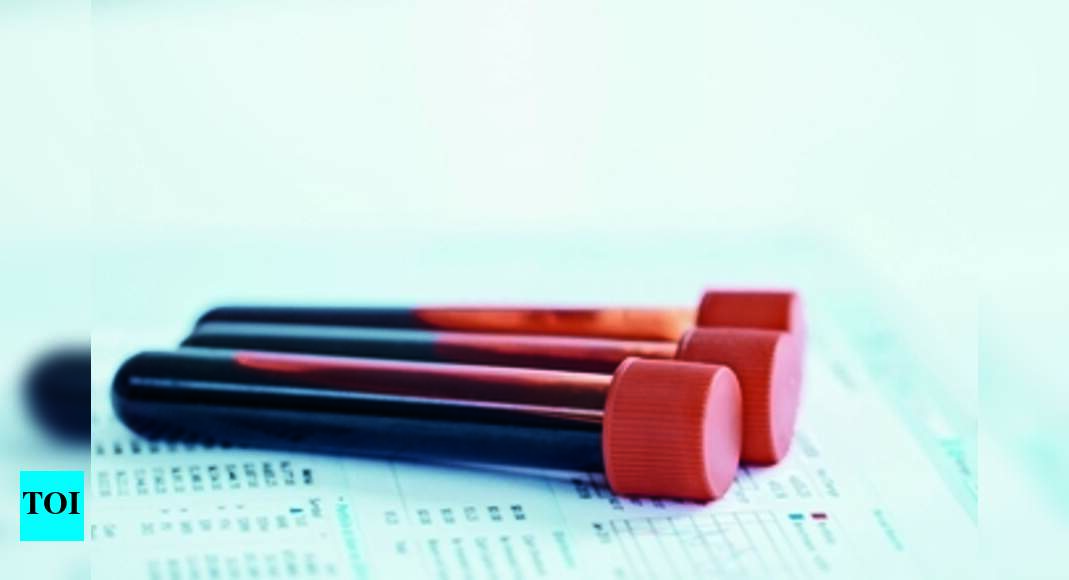 Lab gives HIV+ report without counselling India News Times of India