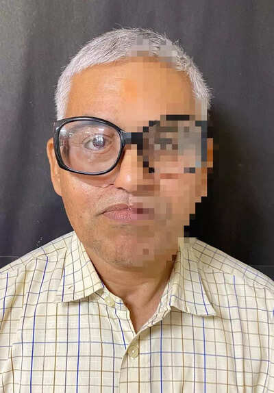 Lucknow: KGMU doctors give back teacher his face, confidence