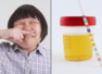Smelly urine indicates THESE problems
