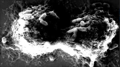 ILS scientists discover new health-promoting probiotic bacteria
