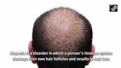 Research finds link between immune system, hair growth | Lifestyle - Times of India Videos Research finds link between immune system, hair growth | Lifestyle - Times of India Videos