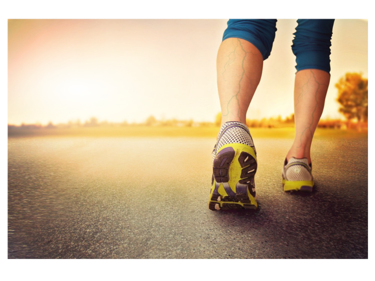 Total 78+ imagen best running shoes for varicose veins Abzlocal.mx