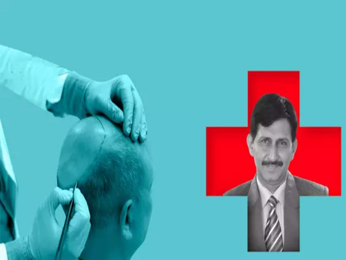 How safe are hair transplants? A doctor explains - Times of India How safe are hair transplants? A doctor explains - Times of India