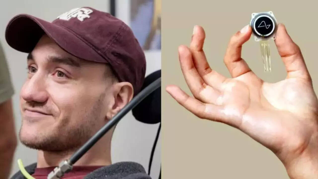 Neuralink's first brain implant patient shares his fears about the device -  Times of India