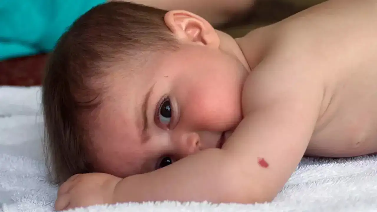 Meaning of birthmarks on different parts of body - Times of India