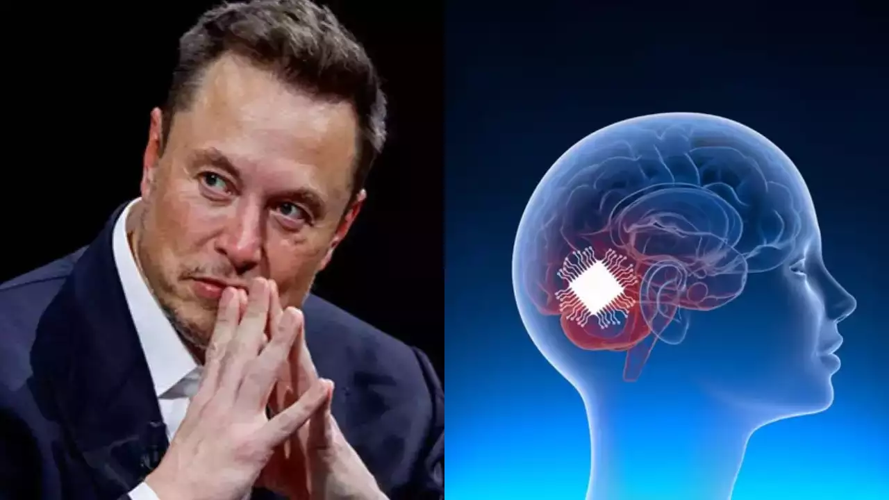 Elon Musk gives an update on Neuralink's third human brain implant: 'We  upgraded…' - Times of India