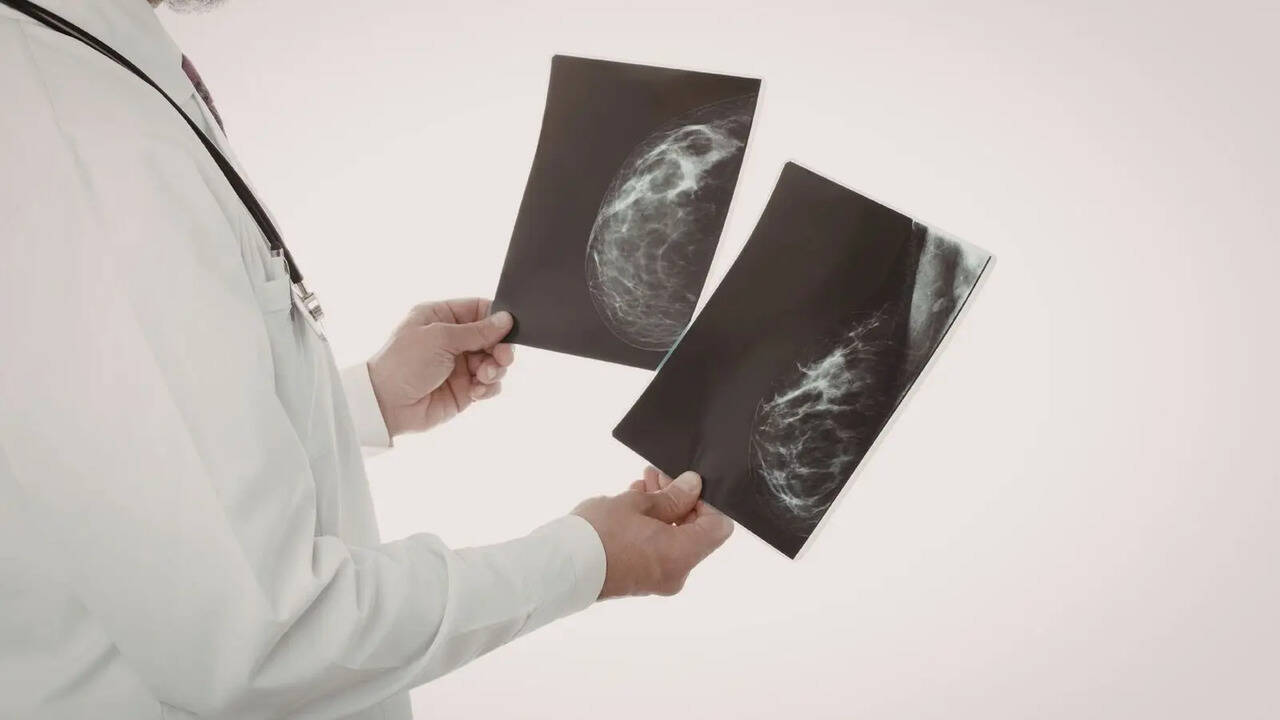 Mammograms are helping docs spot heart disease risk early