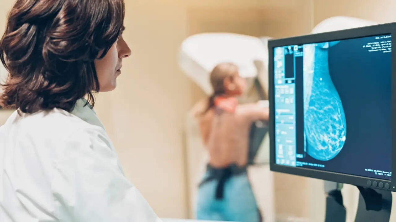 Waiting till 50? New survey warns about a dangerous mammogram myth