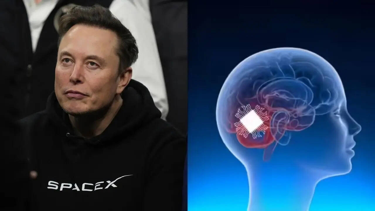 China beats Elon Musk's 'Jesus-level technology' to launch world's first commercial  brain chip - The Times of India