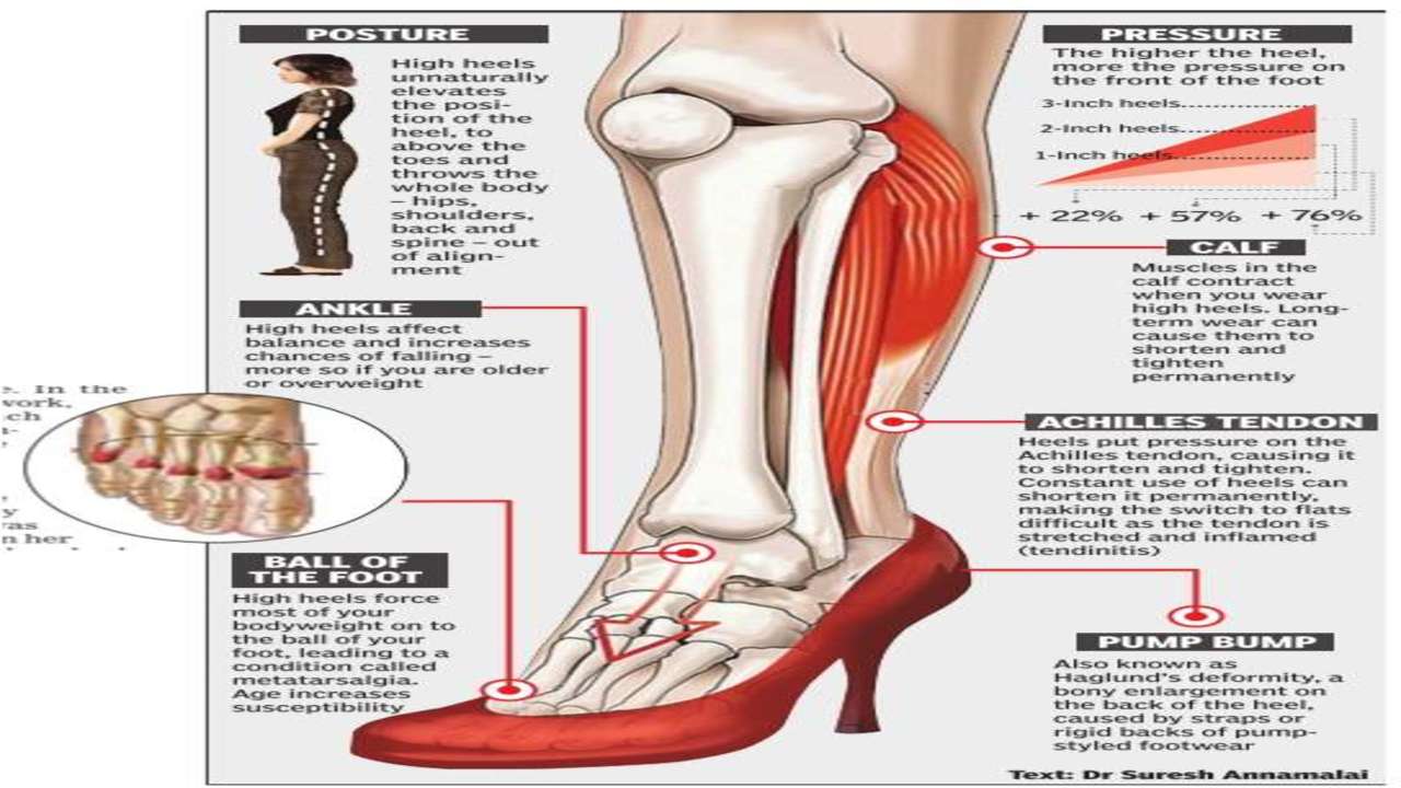 Are Heels Good for Flat Feet