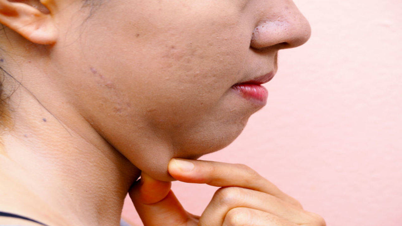 Chin firming online exercises