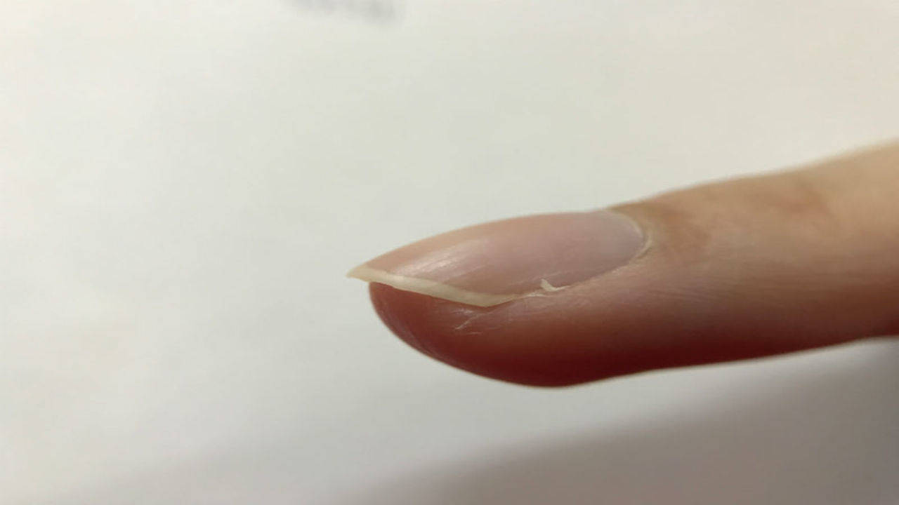 Is that pain in your finger a nail infection?