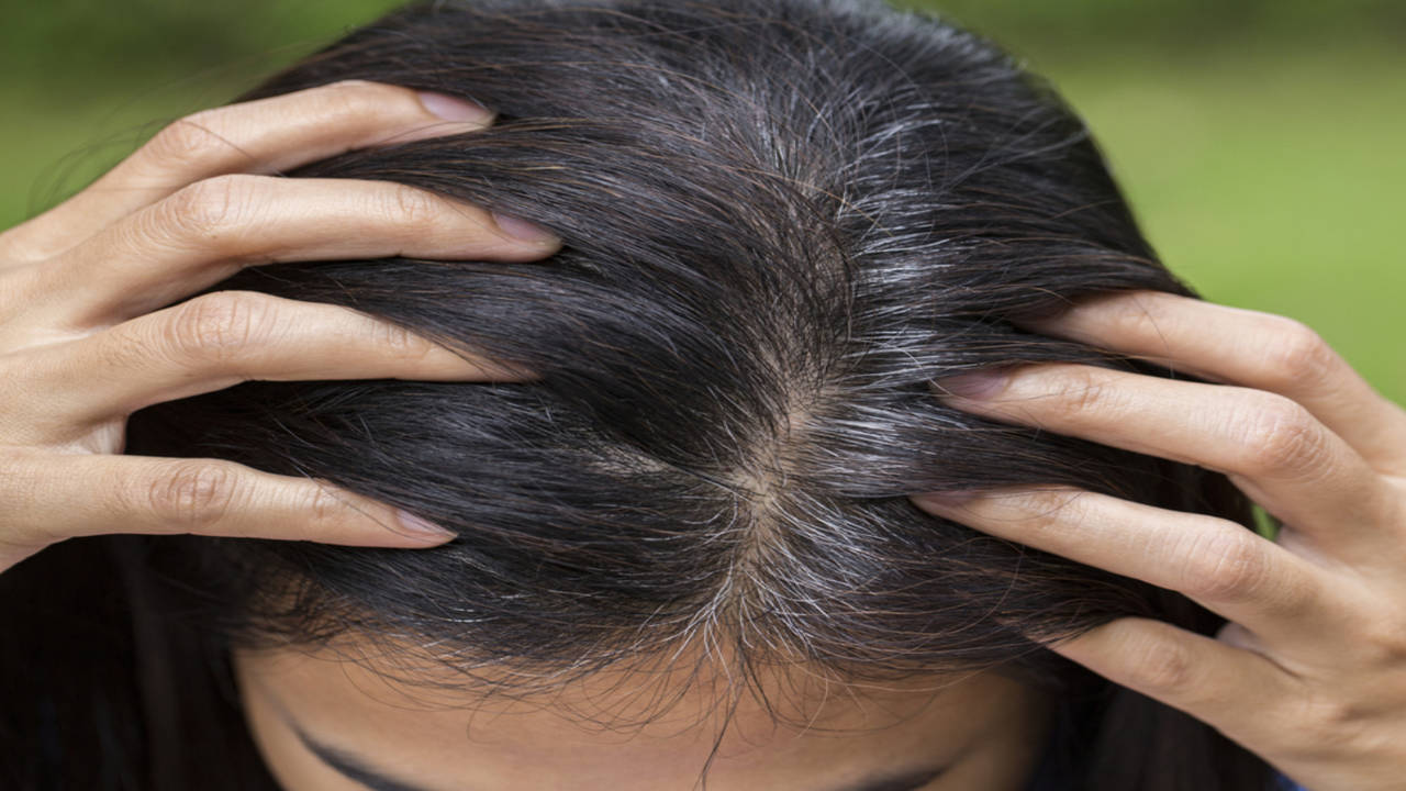 Grey hair at 30? Home remedies to REVERSE the problem | Home Remedy to Get  Rid of Grey Hair