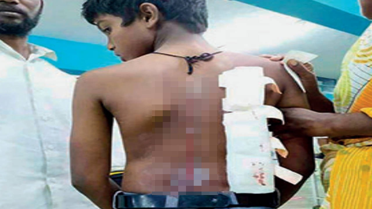 Madurai Schoolboy cuts dalit classmate with blade Madurai News image picture