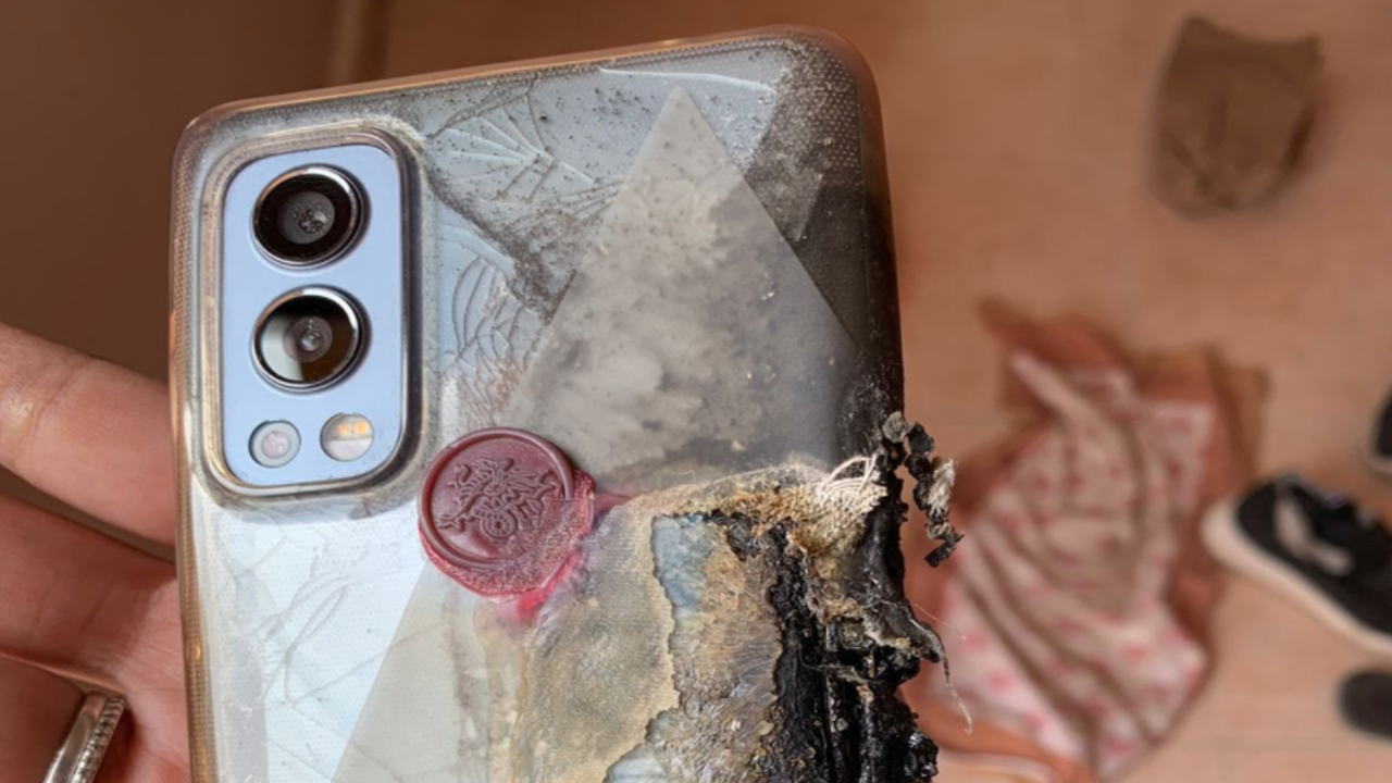 OnePlus Nord 2 explodes in owner's pocket causing second-degree burns,  OnePlus assisting with expenses -  News