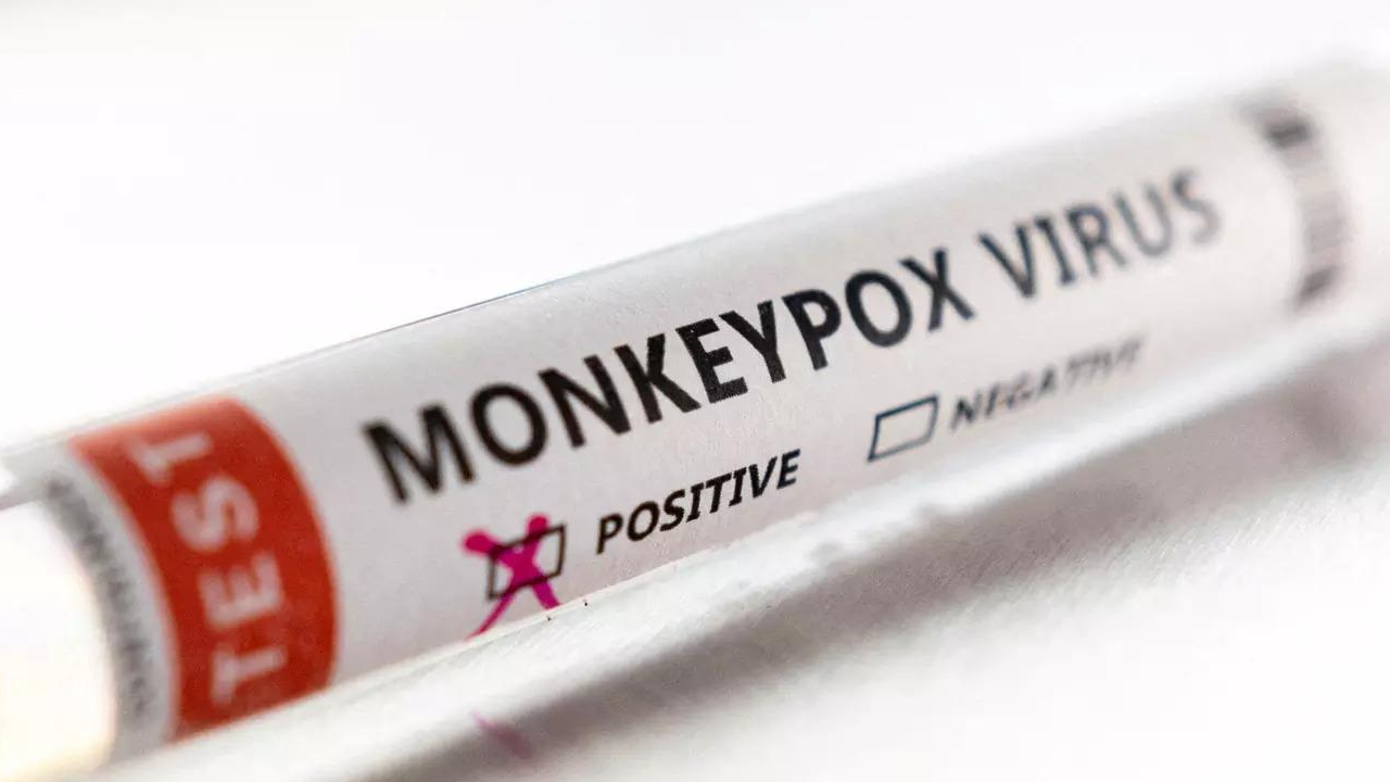 Monkeypox Cases: 780 cases of monkeypox reported or identified as of June  2; WHO | World News - Times of India