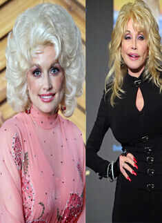Stars Before & After Cosmetic Surgeries