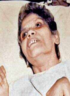 Shanbaug lost her elder sister Shanta Nayak, her only relative in the city, two years ago.  Photogallery Times of India