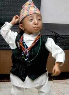 World's smallest man