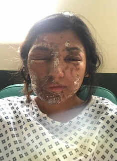 Injured Resham Khan