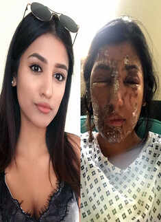 Aspiring Muslim model becomes victim of acid attack