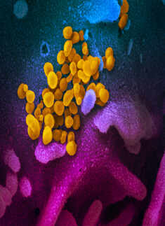 In Pictures: Up close with the coronavirus...