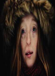 Rare facial defect doesn't stop this German model Ilka Br&uuml;hl from dreaming big