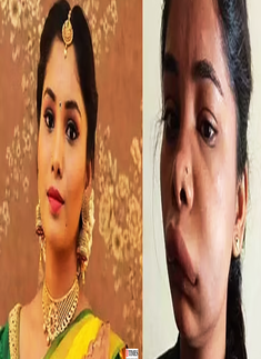 Pictures of Kannada actress Swathi Sathish go viral after her root canal surgery goes wrong