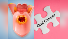 Warning signs of oral cancer to check at home