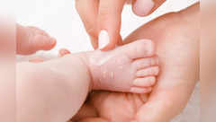 Skin care tips for babies with dry skin