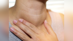 Hypothyroidism: How to lower your TSH