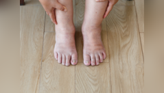 Diabetic nerve damage: How to protect legs, feet