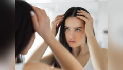 Diet mistakes can cause uncontrolled dandruff