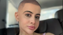 Urfi Javed's bald selfie sparks controversy