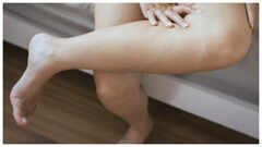 6 hidden deficiencies that legs can point to