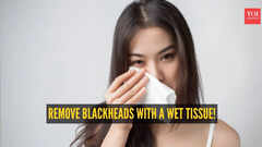 How to remove blackheads with a wet tissue