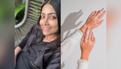 Actor Mamta diagnosed with vitiligo