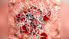 ​Clots and air blocks increased after COVID