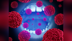 Oral cancer signs you shouldn't ignore