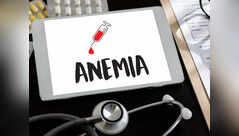 Iron deficiency anemia: 3 noticeable signs