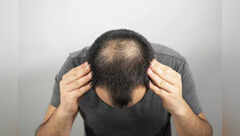 Best hair oils for people losing hair