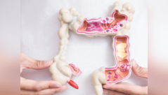 Colon cancer is rising among young adults