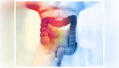 Colon cancer on rise: Don't miss signs